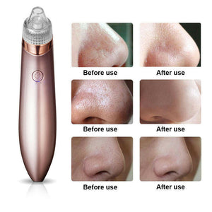 Electric Blackhead Vacuum Cleaner Pore Cleaner Acne Remover